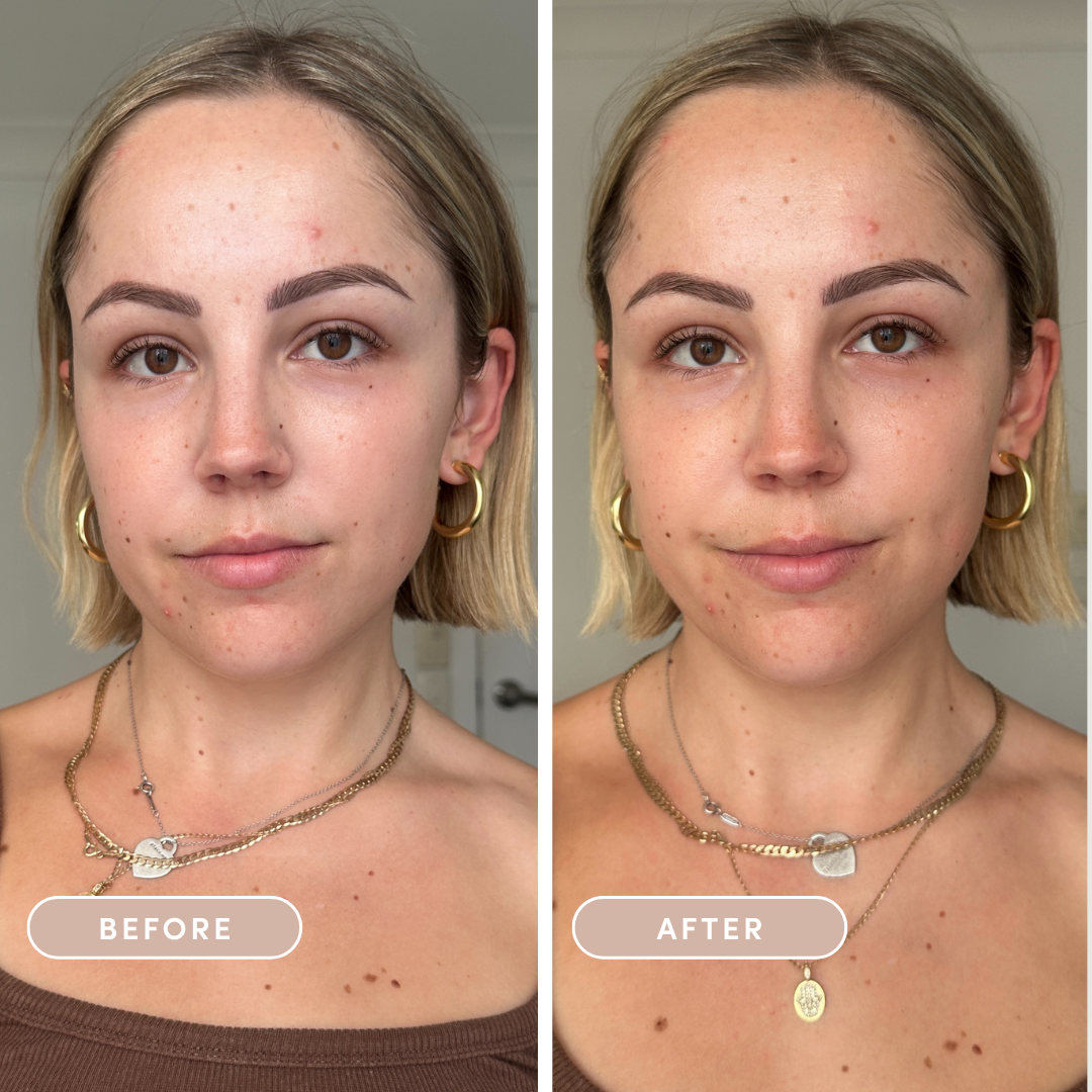 esei Sunkiss Serum