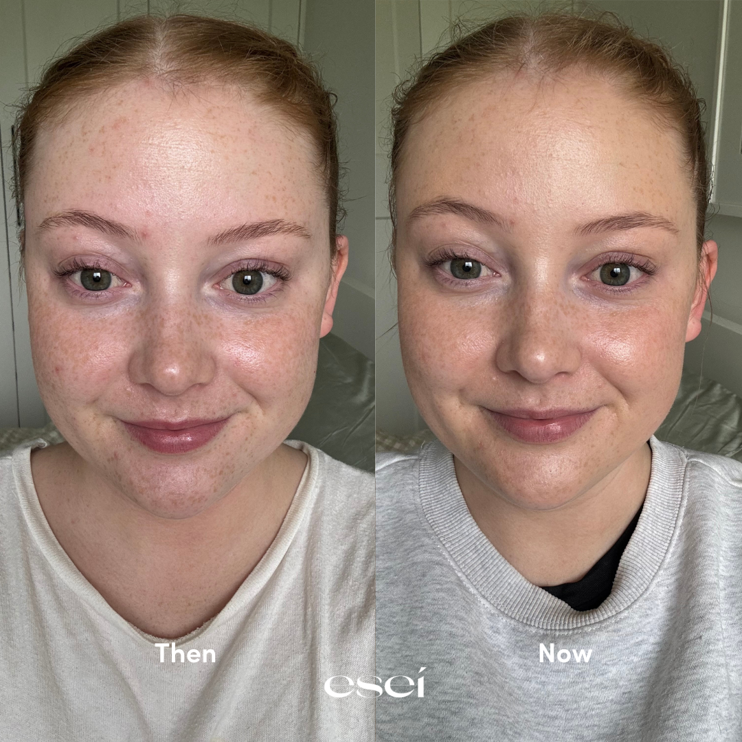 Sunkiss Self-Tanning Serum