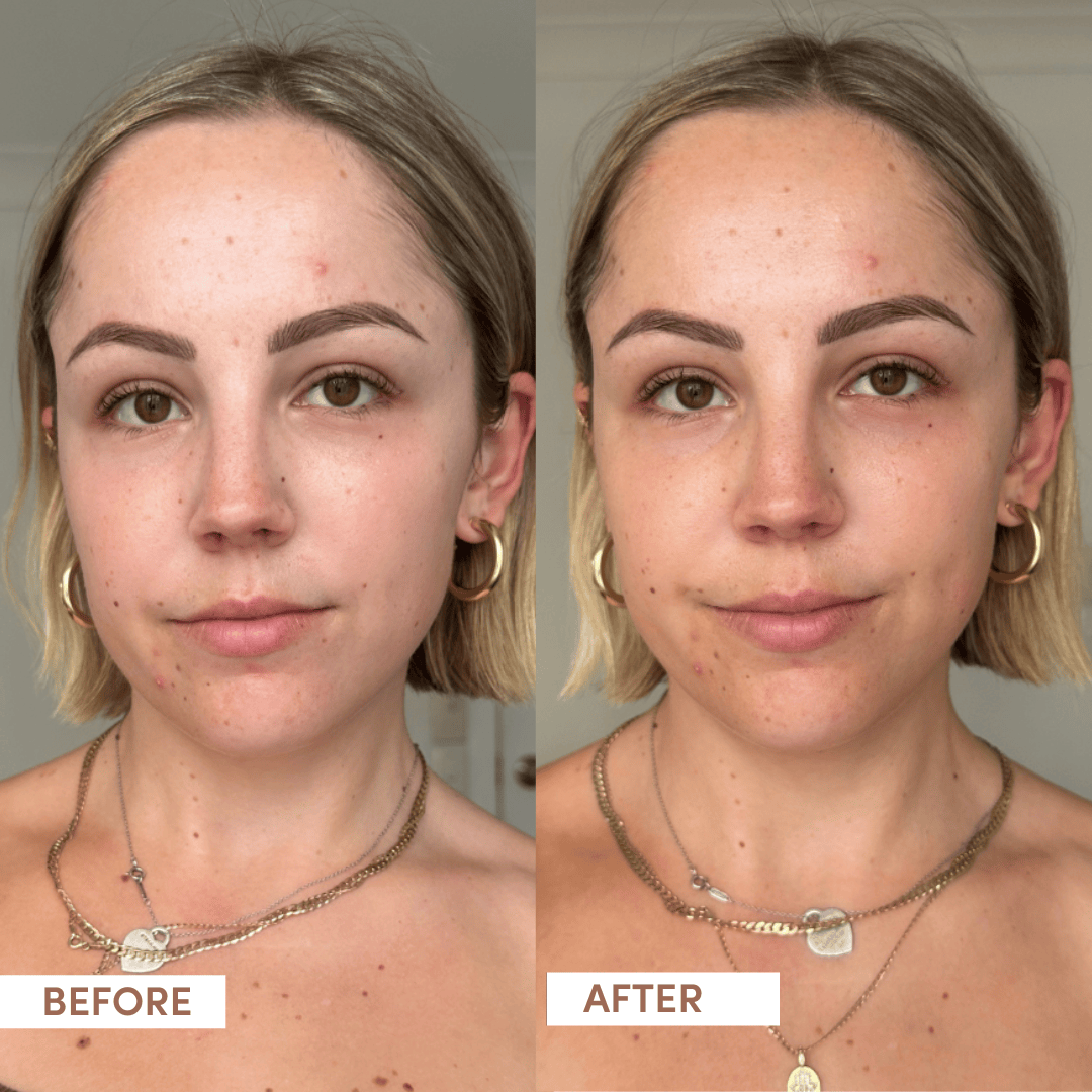 Sunkiss + Hydrate Duo