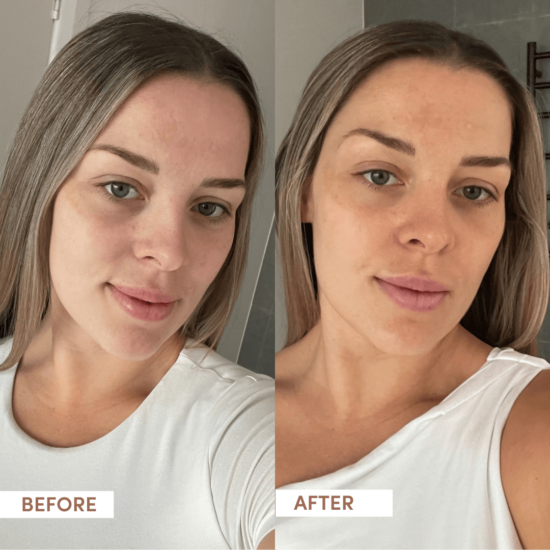 Before and after comparison of a woman with a neutral expression.