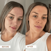 Before and after comparison of a woman with a neutral expression.