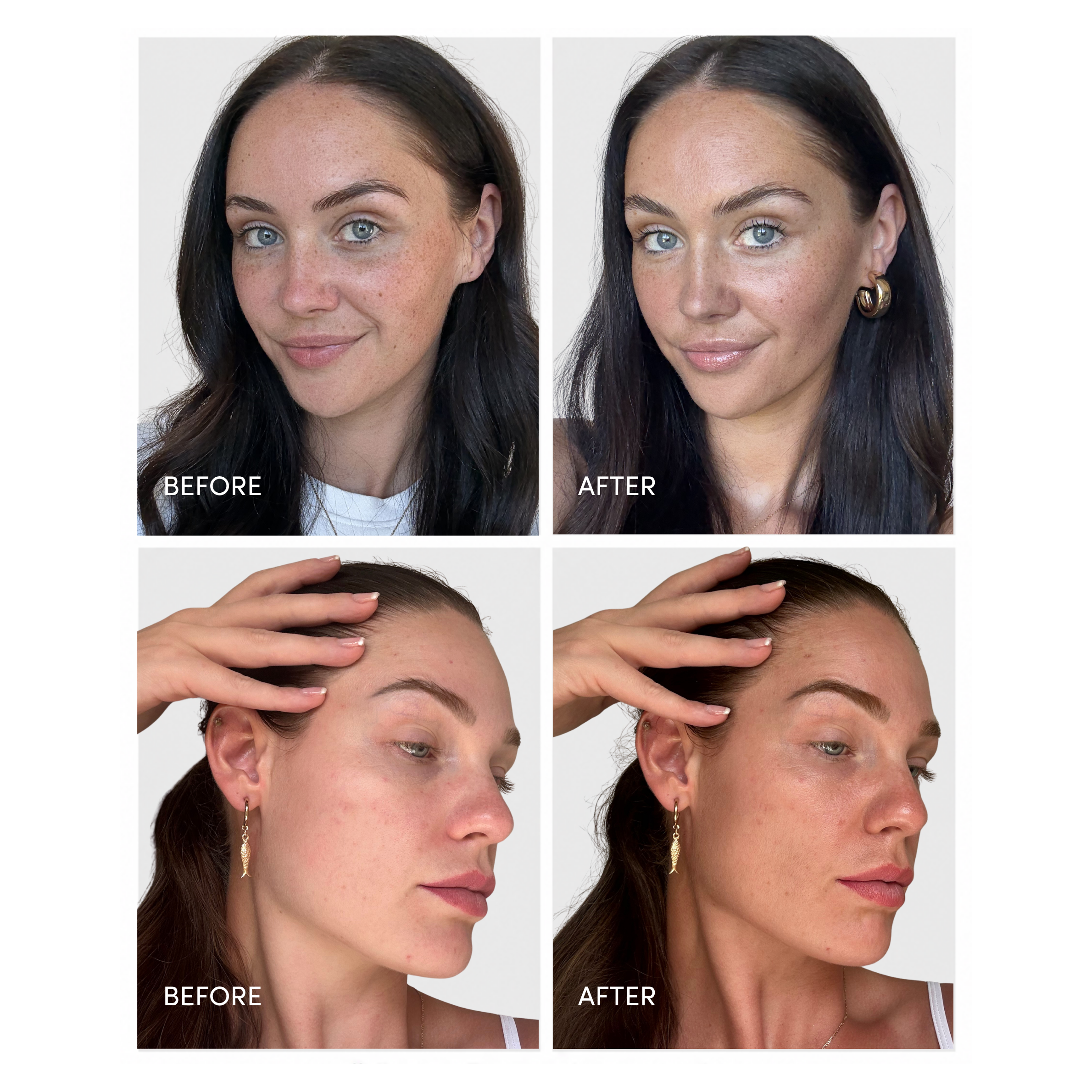 1-before-after