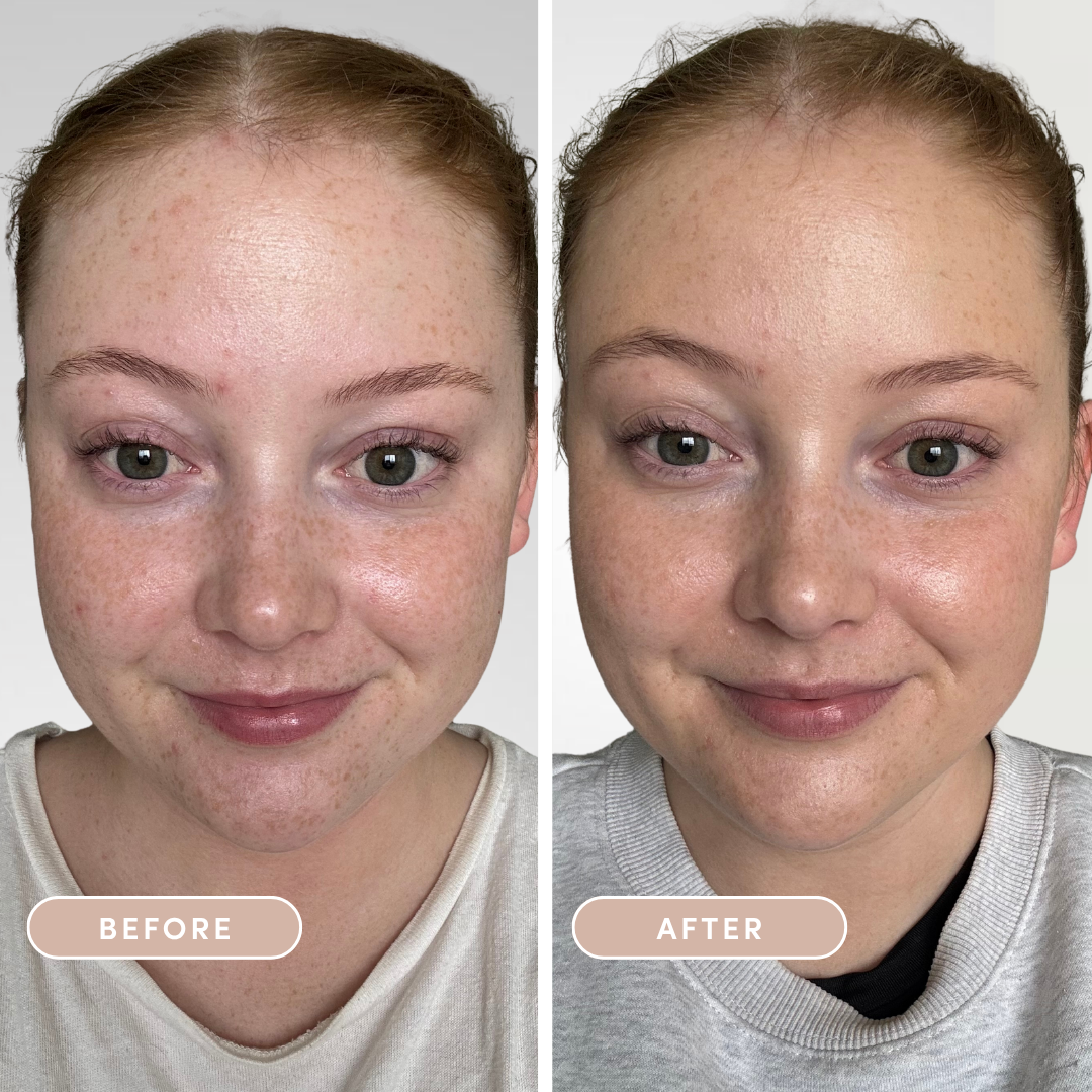 esei Sunkiss Serum